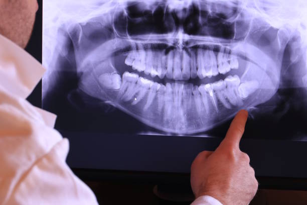 Best Emergency Tooth Extraction in Holcom, KS